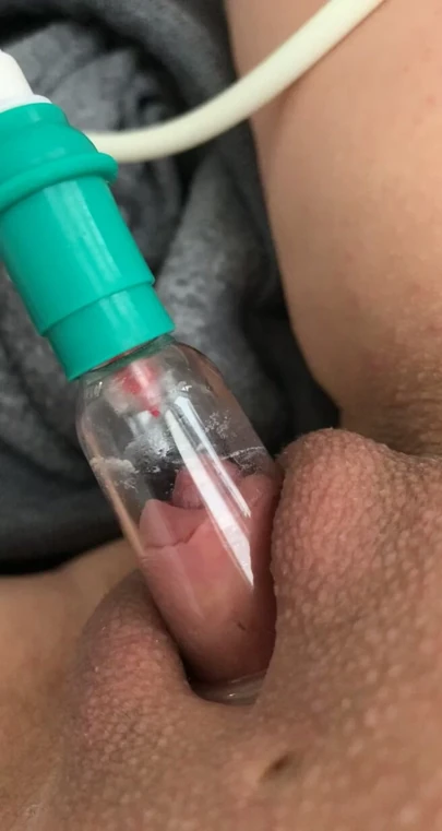 Klit Pump